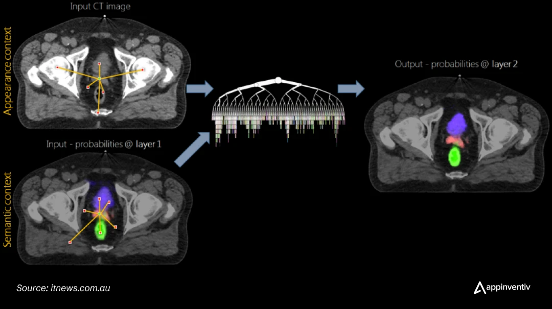 AI in medical image analysis